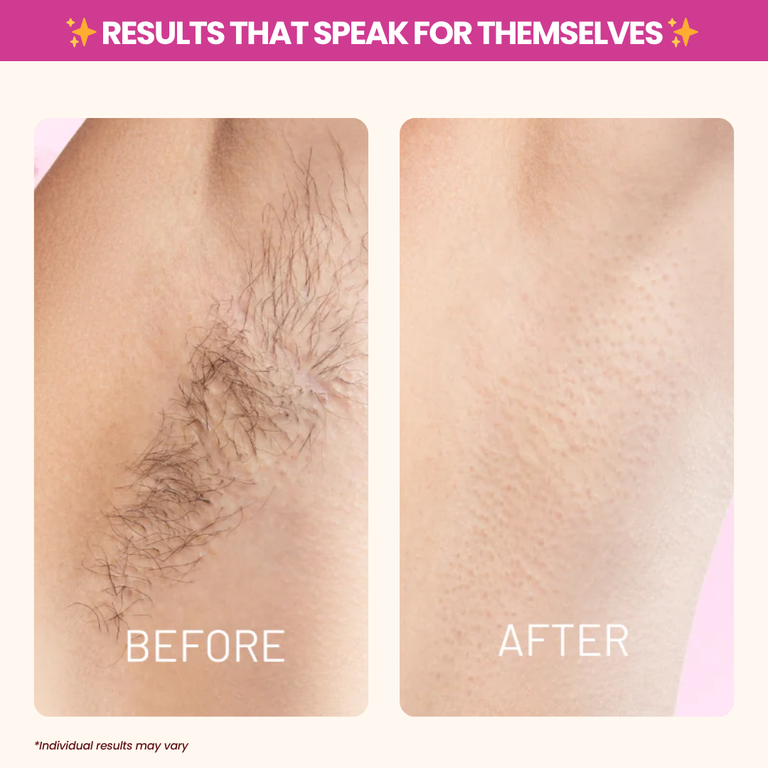 AxiOra Cyperus Rotundus Oil TM