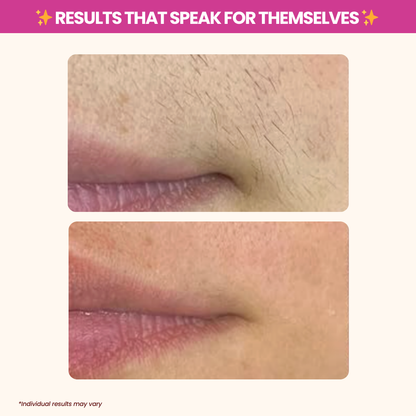 AxiOra Cyperus Rotundus Oil TM