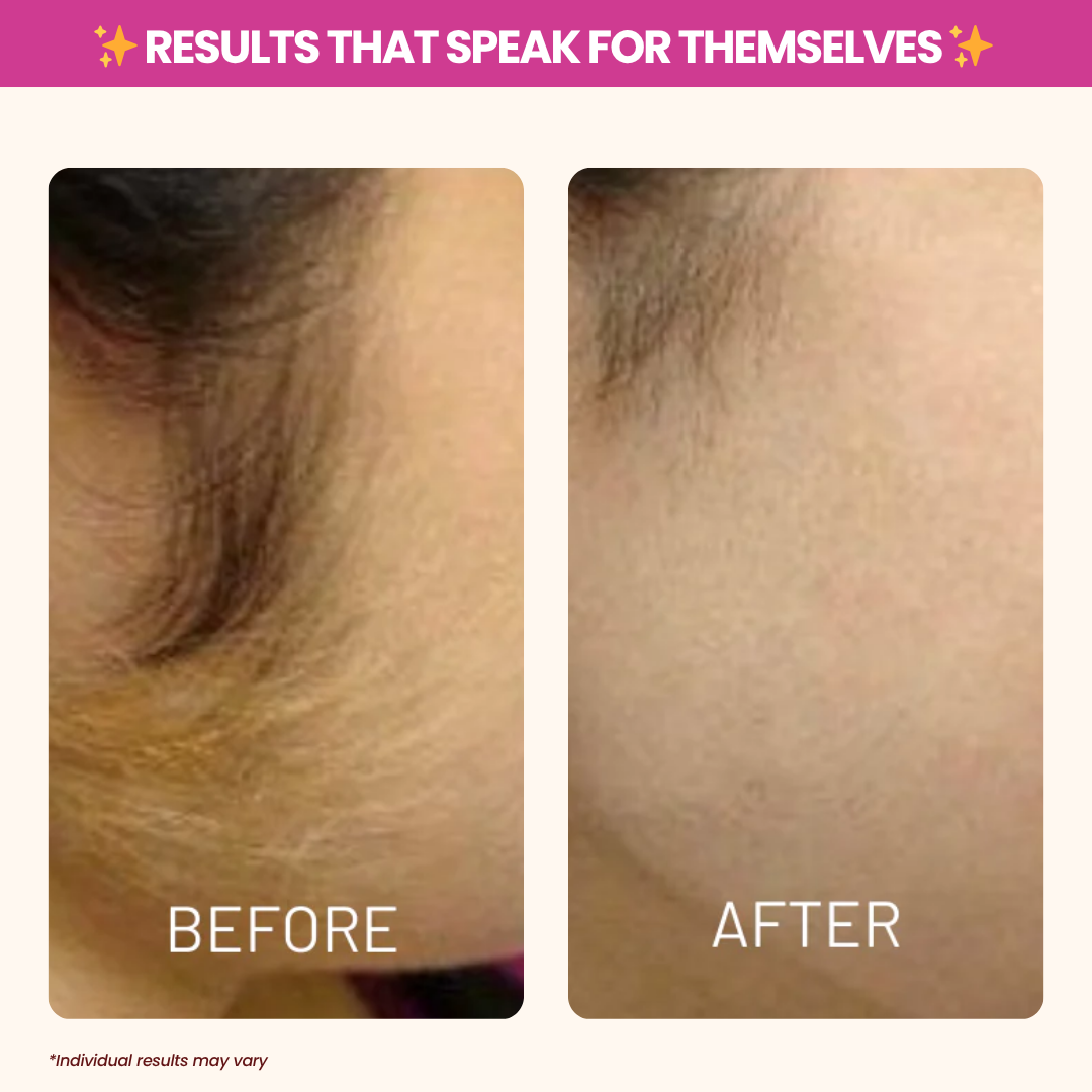 AxiOra Cyperus Rotundus Oil TM