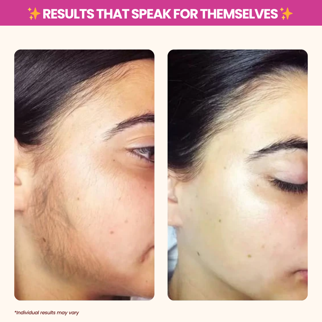 AxiOra Cyperus Rotundus Oil TM